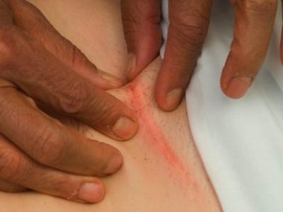 scar tissue massage